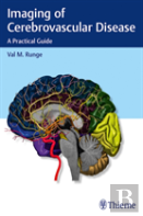 Imaging Of Cerebrovascular Disease