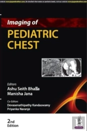 Imaging Of Pediatric Chest