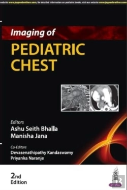 Bertrand.pt - Imaging Of Pediatric Chest