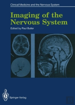 Bertrand.pt - Imaging Of The Nervous System