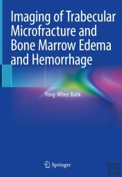 Bertrand.pt - Imaging Of Trabecular Microfracture And Bone Marrow Edema And Hemorrhage