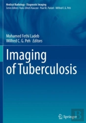 Imaging Of Tuberculosis