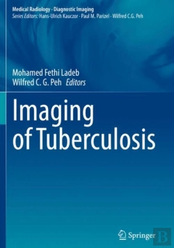 Bertrand.pt - Imaging Of Tuberculosis