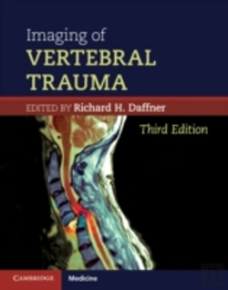 Bertrand.pt - Imaging Of Vertebral Trauma