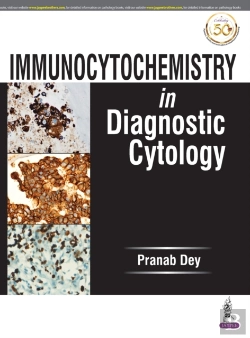 Bertrand.pt - Immunocytochemistry In Diagnostic Cytology