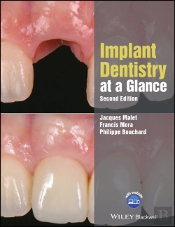 Bertrand.pt - Implant Dentistry At A Glance