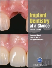 Implant Dentistry At A Glance