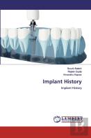 Implant History