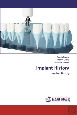 Bertrand.pt - Implant History