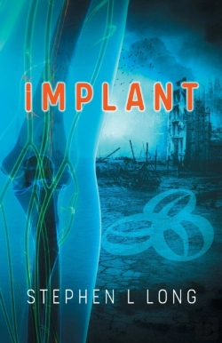 Bertrand.pt - Implant