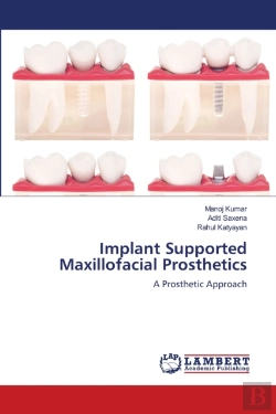 Bertrand.pt - Implant Supported Maxillofacial Prosthetics