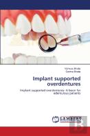 Implant Supported Overdentures