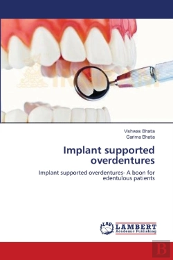 Bertrand.pt - Implant Supported Overdentures