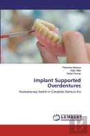 Implant Supported Overdentures