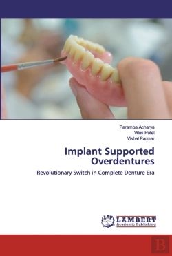Bertrand.pt - Implant Supported Overdentures