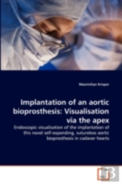 Implantation Of An Aortic Bioprosthesis
