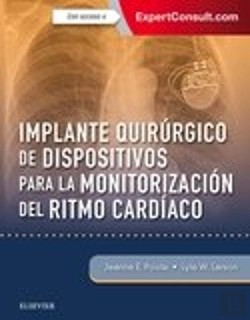 Bertrand.pt - Implante Quirúrgico De Dispositivos Para La Monitorización Del Ritmo Card¡Aco + Expertconsult