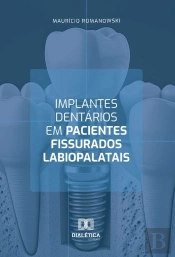 Implantes Dentários Em Pacientes Fissurados Labiopalatais
