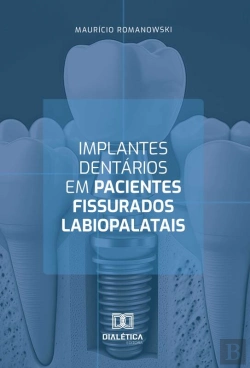Bertrand.pt - Implantes Dentários Em Pacientes Fissurados Labiopalatais