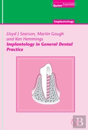 Implantology In General Dental Practice