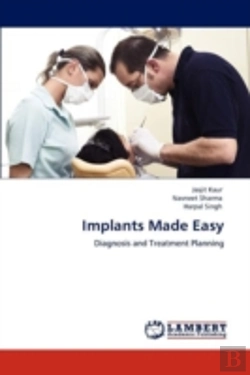 Bertrand.pt - Implants Made Easy