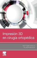 Impresión 3d En Cirugía Ortopédica