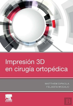 Bertrand.pt - Impresión 3d En Cirugía Ortopédica