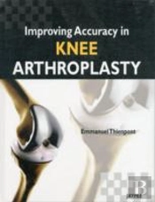 Improving Accuracy In Knee Arthroplasty