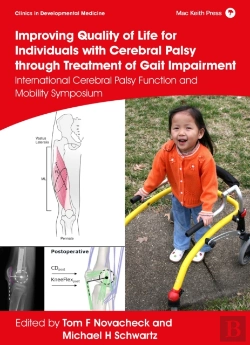 Bertrand.pt - Improving Quality Of Life For Individuals With Cerebral Palsy Through Treatment Of Gait Impairment