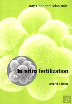 Bertrand.pt - In Vitro Fertilization