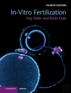 Bertrand.pt - In-Vitro Fertilization