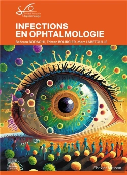 Bertrand.pt - Infections En Ophtalmologie : Rapport Sfo 2024
