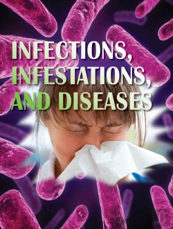 Bertrand.pt - Infections, Infestations, And Diseases