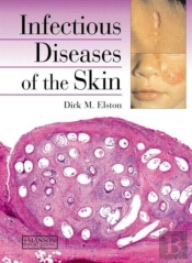 Infectious Diseases Of The Skin