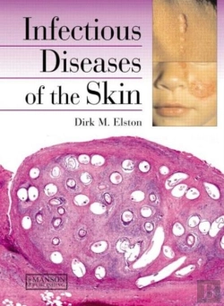 Bertrand.pt - Infectious Diseases Of The Skin