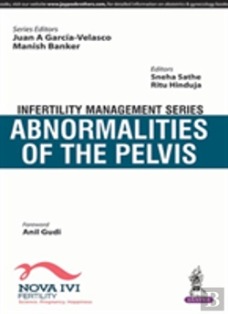 Bertrand.pt - Infertility Management Series: Abnormalities Of The Pelvis
