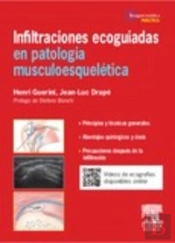 Infiltraciones Ecoagudas En Patologia Musculoesqueletica 