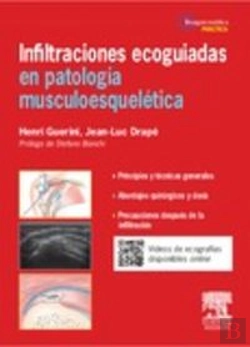 Bertrand.pt - Infiltraciones Ecoagudas En Patologia Musculoesqueletica 