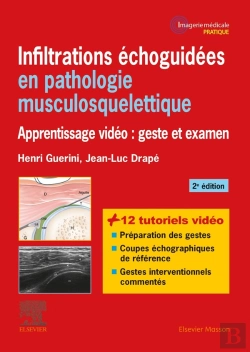 Bertrand.pt - Infiltrations Échoguidées En Pathologie Musculosquelettique ; Apprentissage Vidéo : Geste Et Examen