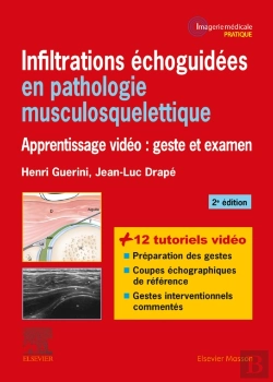 Bertrand.pt - Infiltrations Echoguidees En Pathologie Musculosquelettique