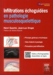 Infiltrations Échoguidées