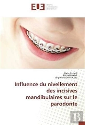 Influence Du Nivellement Des Incisives Mandibulaires Sur Le Parodonte
