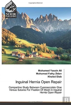 Bertrand.pt - Inguinal Hernia Open Repair