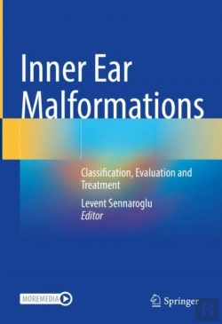 Bertrand.pt - Inner Ear Malformations
