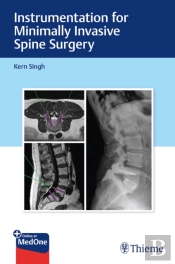 Instrumentation For Minimally Invasive Spine Surgery
