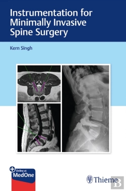 Bertrand.pt - Instrumentation For Minimally Invasive Spine Surgery