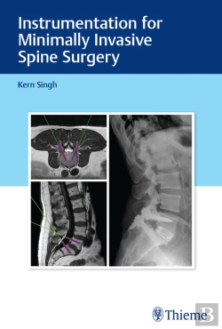 Bertrand.pt - Instrumentation For Minimally Invasive Spine Surgery