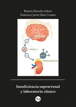 Bertrand.pt - Insuficiencia Suprarrenal Y Laboratorio Clínico