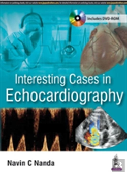 Bertrand.pt - Interesting Cases In Echocardiography