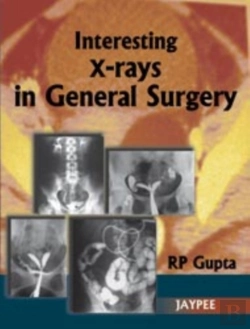 Bertrand.pt - Interesting X-Rays In General Surgery